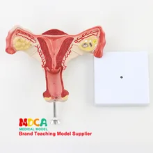 Матки человека модель репродуктивной системы планирования семьи матки детородной анатомической модели обучения медицине Mszxt002