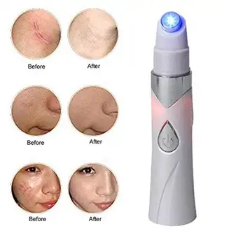 

Face Acne Removal Pen Blue Light Therapy Treatment Pen Electronic Beauty Instrument Anti-Acne Artifact masajeador facial cleaner
