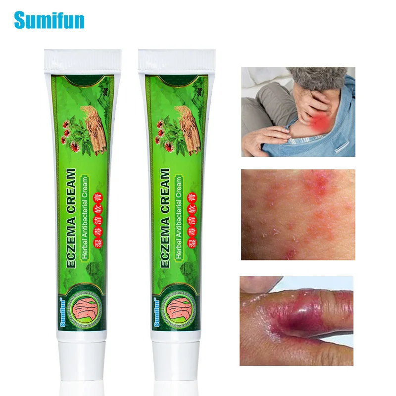 Sumifun Eczema крем для кожи псориаз мазь дерматит экзематоид ингибирует бактерии зуд