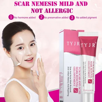 comprar 15g Acne Manchas Tratamento Reparação Da Pele Creme De Rosto Escalda Estiramento Reparação Creme Cirúrgico Tratamento Da Cicatriz Clareamento Creme