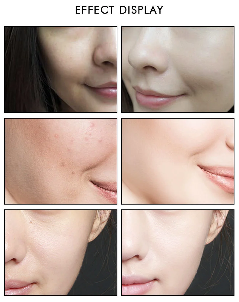 nicotinamide-serum_11