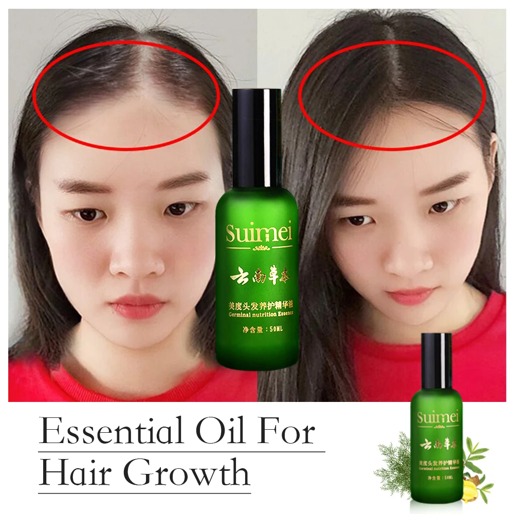 Ceny Do włosów serum wzrostu Essential Oil Anti utrata włosów leczenie uszkodzenia naprawy włosów leczenie gęste szybki wzrost włosów tonik do włosów