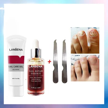 

Nail Care Gel + NailRepair Essence Treatment Prevention Toenail FungusIinfection Nourish Care Hand And Foot2pcs