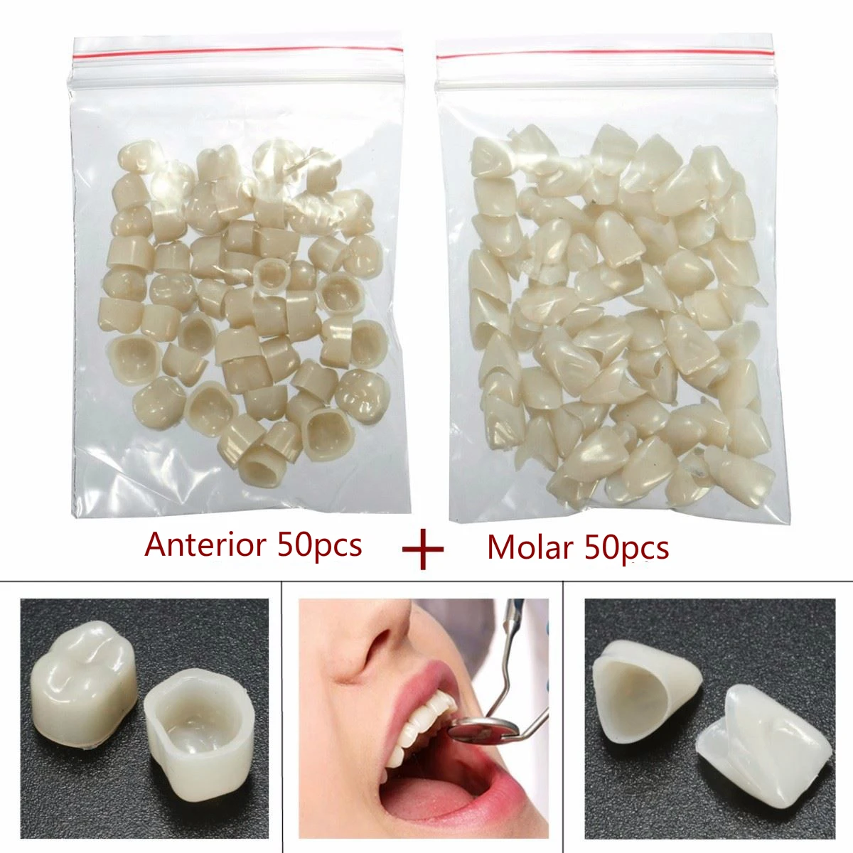 

2 Packs Dental Materials Mixed Temporary Crown Posterior Veneers Teeth Dentist Products Teeth Whitening Fake Teeth Supplies