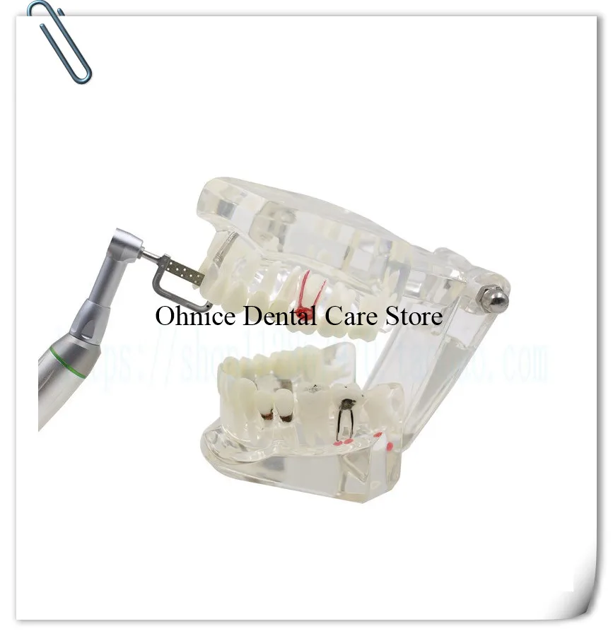 Стоматологический ортодонтический инструмент интерпроксимальная эмаль