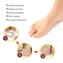 

1Pcs/5Pcs/10Pcs Toenails Sticker Practical Compact Flexible for Professional Use Paronychia Decal Paronychia Patch