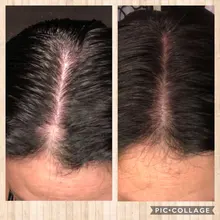 Cuidado del cabello para el crecimiento del cabello aceites esenciales esencia Original auténtico 100% pérdida de cabello líquido salud belleza suero denso para el crecimiento del cabello