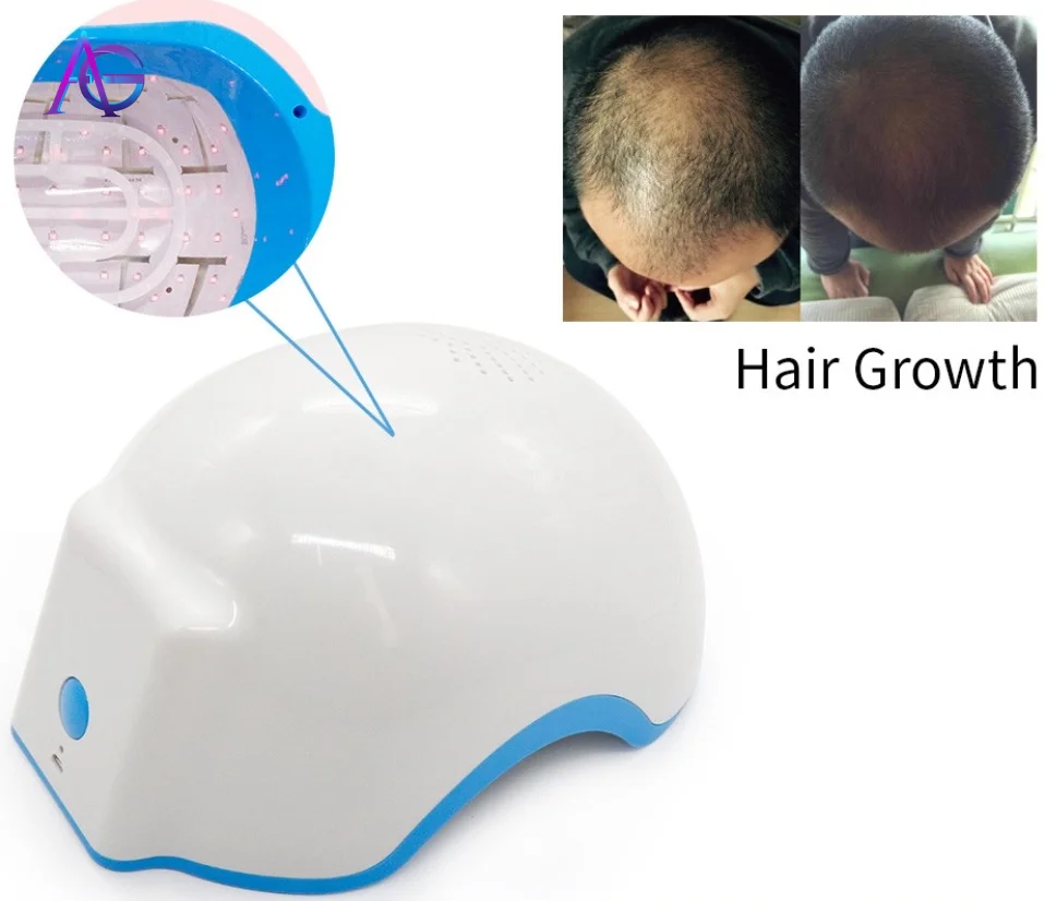  New Portable LED Anti-hair loss Hair growth HELMET - 4000120201039