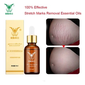 

Stretch Marks Removal Essential Oils Pure Natural Stretch Marks Remover Obesity Postpartum Anti-wrinkle Repair Cream Skin Care