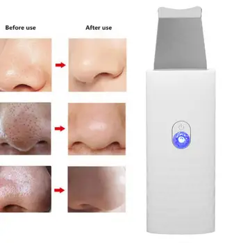 

Mini White Face Skin Scrubber Ultrasonic Facial Cleanser Exfoliating Remove Blackheads Pore Cleanser Pore Cleaner