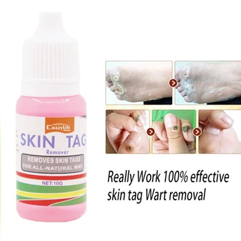 

10ml Body Warts Treatment Cream Skin Tag Remover Foot Corn Removal Plantar Genital Warts Ointment Foot Care Cream D378