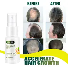 Effective Plant Extract Series Unisex Anti Hair Loss Hair Care Germinal Dense Serum Pilatory Ginger Hair Growth Spray