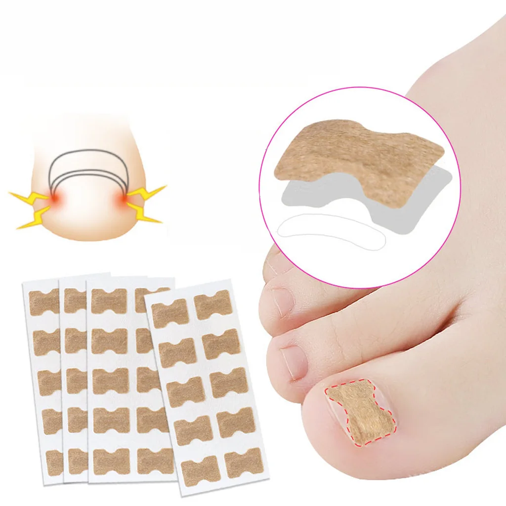 

5pcs Glue Free Ingrown Toenail Patch Set Toenail Correction Pedicure Tools Inlay Nail Corrector Stickers Nail Foot Care