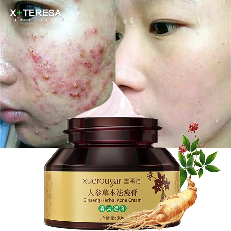 ginseng acne cream