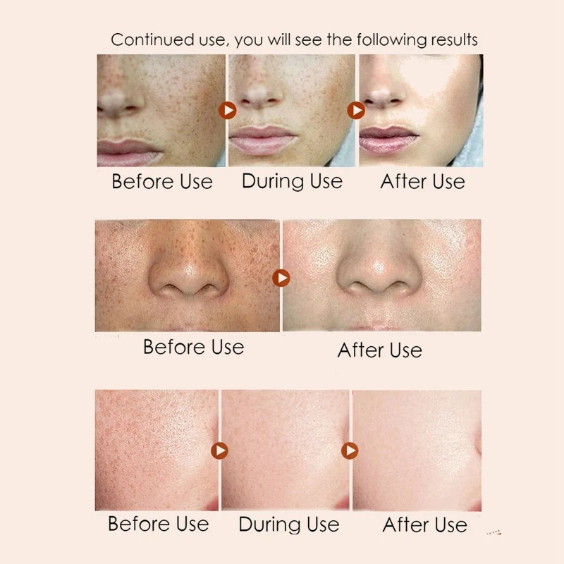 Retinol Эфирная сыворотка увлажнитель для лица Крем Антивозрастной осветлитель для лица увлажняющая отбеливающая эссенция крем для ухода за кожей R1