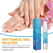 Средство для удаления кутикулы, трав, лечение грибковых ногтей, гель для удаления грибка ног, уход за ногами, эссенция для отбеливания ног, яркое средство против инфекции