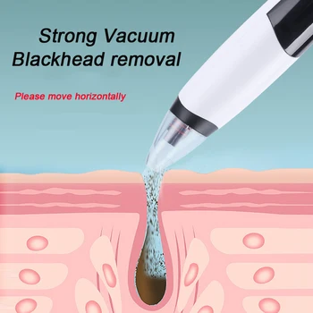 

Electric Vacuum Blackhead Remover Pimple Removal Face Skin Care Tool Acne Cleaner