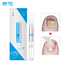 Удаление серое покрытие ногтей Лечение Onychomycosis Paronychia противогрибковые инфекции эфирные китайские Травяной Уход лекарственная жидкость