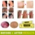 Advanced Body Psoriasis Cream For Dermatitis And Eczema Pruritus Psoriasis Мазь Травяные Кремы Лосьон Для Тела Травяной Крем TSLM2