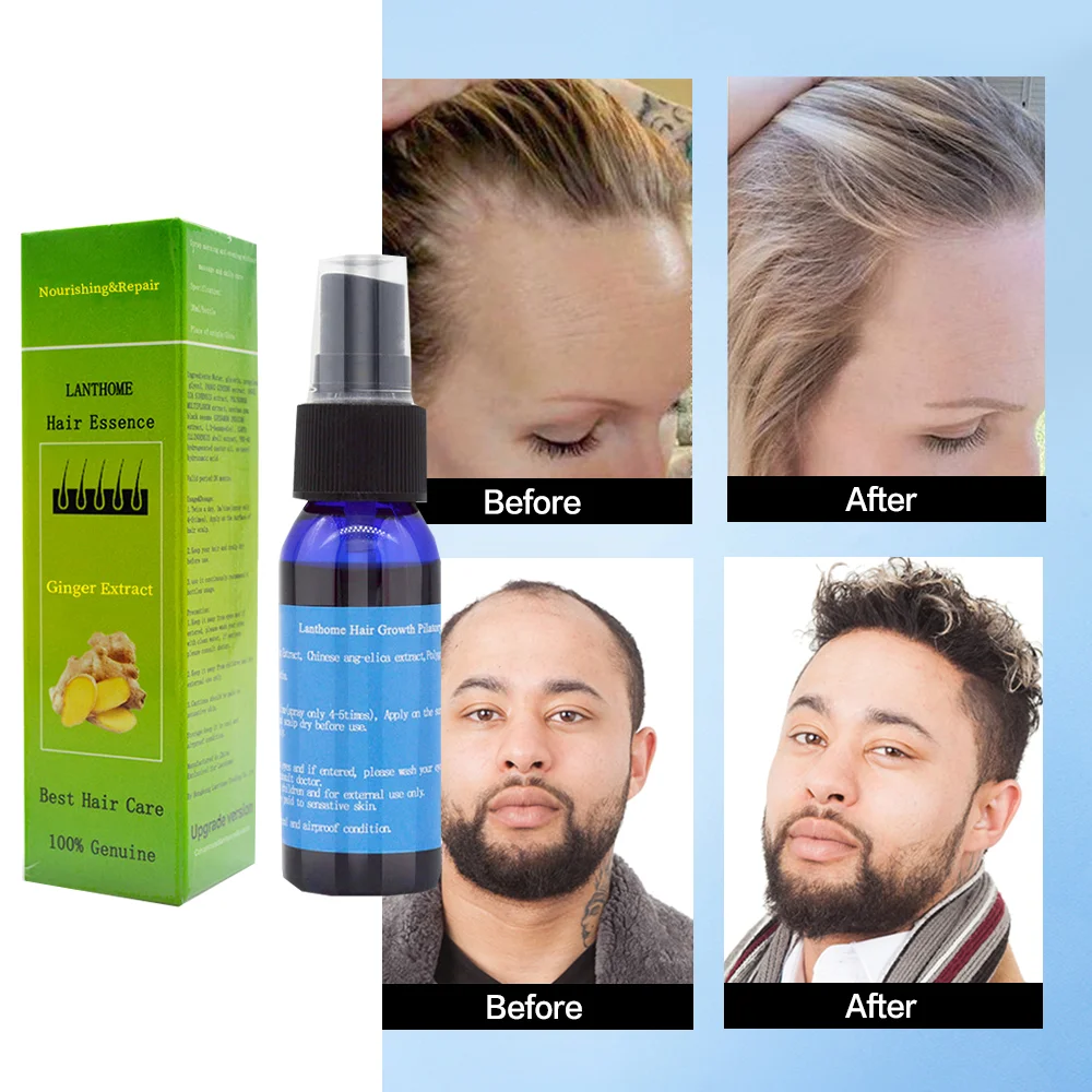 Продукты от выпадения волос для быстрого лечения роста эссенция масло