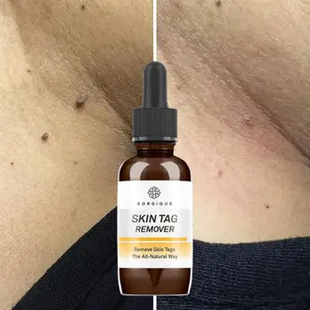 

10/20/30ml Skin Tag Remover Mole Foot Corn Wart Care Serum Essence Essence Hyaluronic Oil Pure 100% Natural Acid R4P0