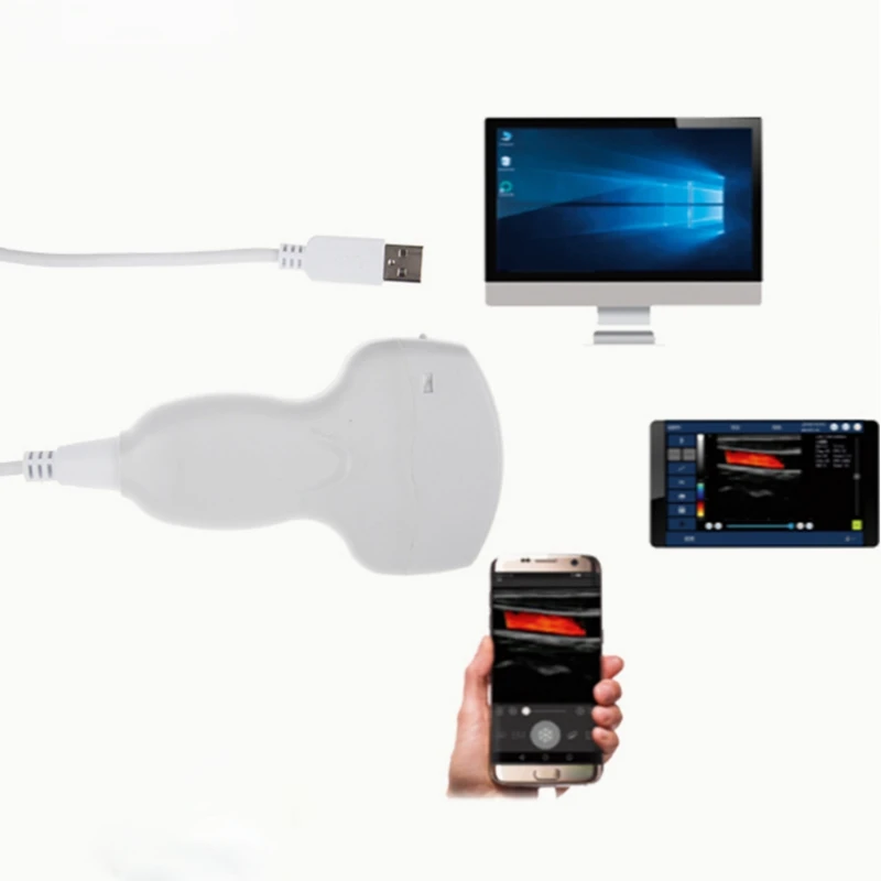 Cheapest portable color Doppler ultrasound machine/CE iPhone /Android connect wireless ultrasound machines Linear probe