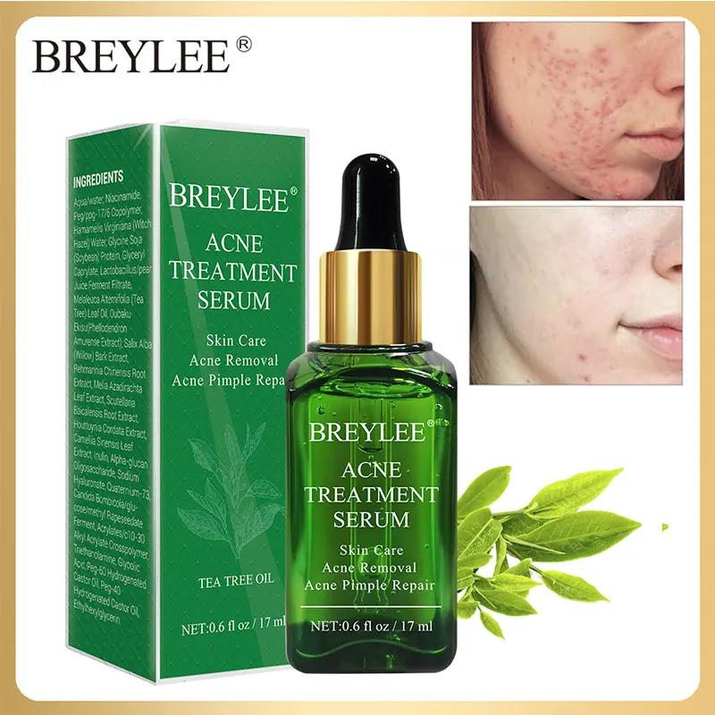 Acne Treatment Serum Лечение акне BREYLEE Удаление прыщей экстракт для лица увлажняющий сужает поры осветляет Гладкий уход за кожей лица Ремонт Ance - Вес нетто: Acne Treatment Serum