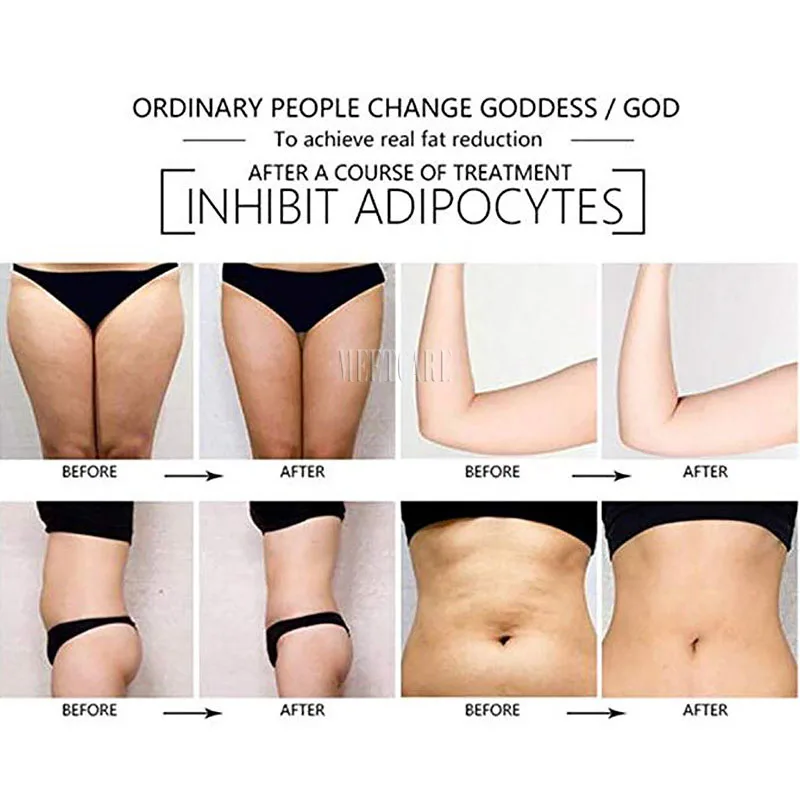 Professional Lipo Laser Slimming Machines Portable Home use 14 Pads Lipolaswer Beauty Loss Weight E