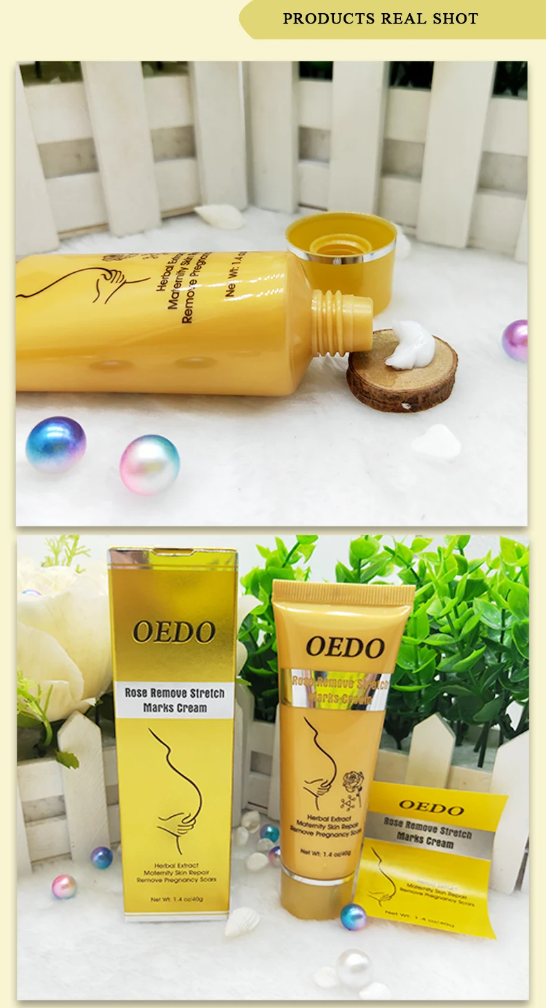 oedo stretch mark cream price