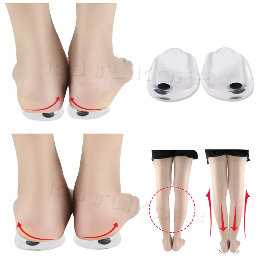 Shoe Insoles Magnetic Massage Gel O/X Type Leg Orthotics Heel Pads Corrective Valgus Varus Foot Insert Pads