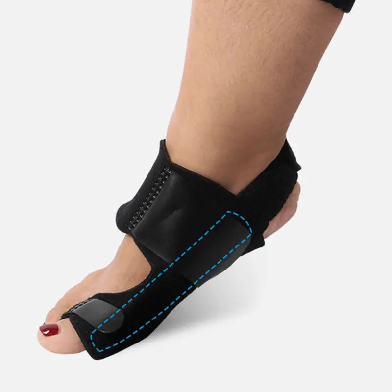 Bunion Splints корректор вальгусной деформации большого пальца ноги Сепаратор Выпрямитель с сплава Strp