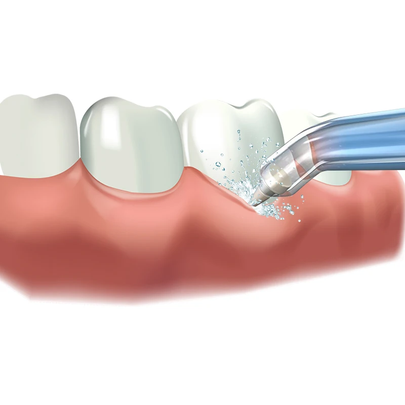 Водяной Пульс 1 шт. сменный пародонтальный наконечник для воды Флоссер ирригатор для полости рта сопло струйный наконечник гигиена зубная нить аксессуары