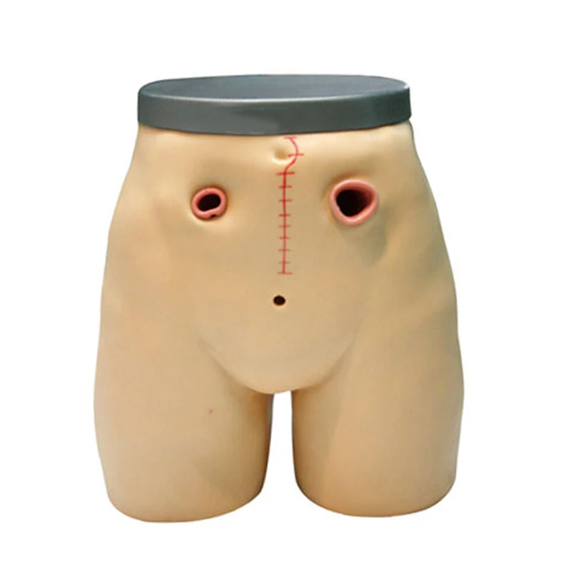 38 Fistulostomy 1