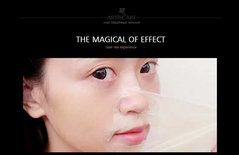 rose-blackhead-removal_07