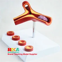 Артерии. Закаливающая модель с тромбусом Guanxin. Сосудистая анатомия, поверхностная модель для обучения медицине Mxg002