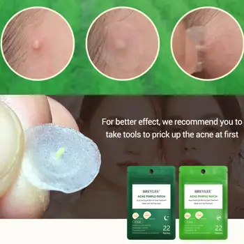 

BREYLEE Acne Remover Patch Mask Anti Acne Blackhead Tools Treatment Patches Blemish 22 Care Pimple Skin Sticker Y8A3