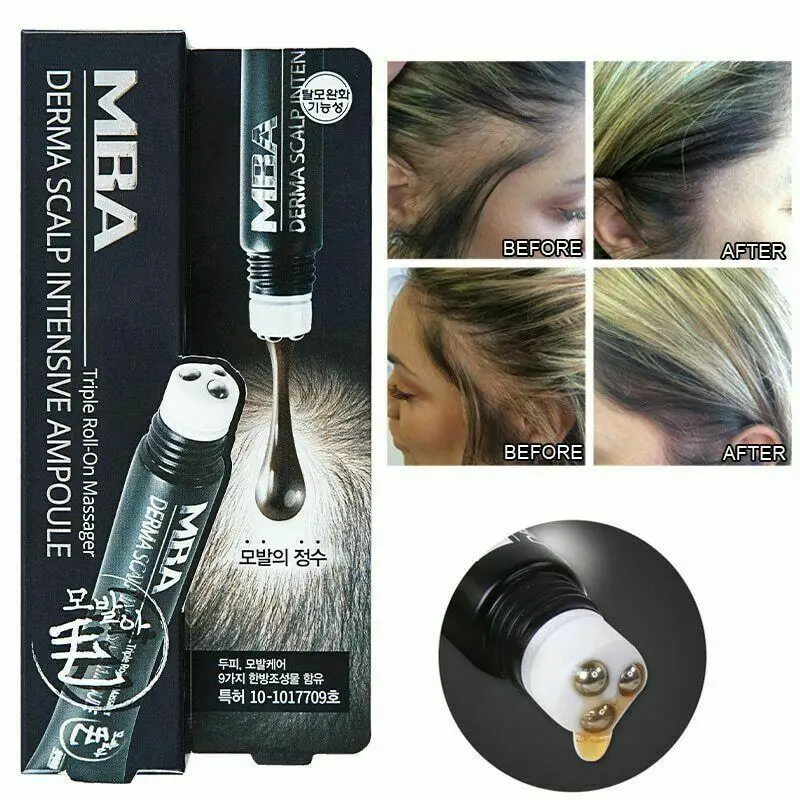 Fast Anti Preventing Hair Lose Liquid Nourish Growth Essential Serum Derma Scalp Intensive Ampoule Triple Roll Massager Set |