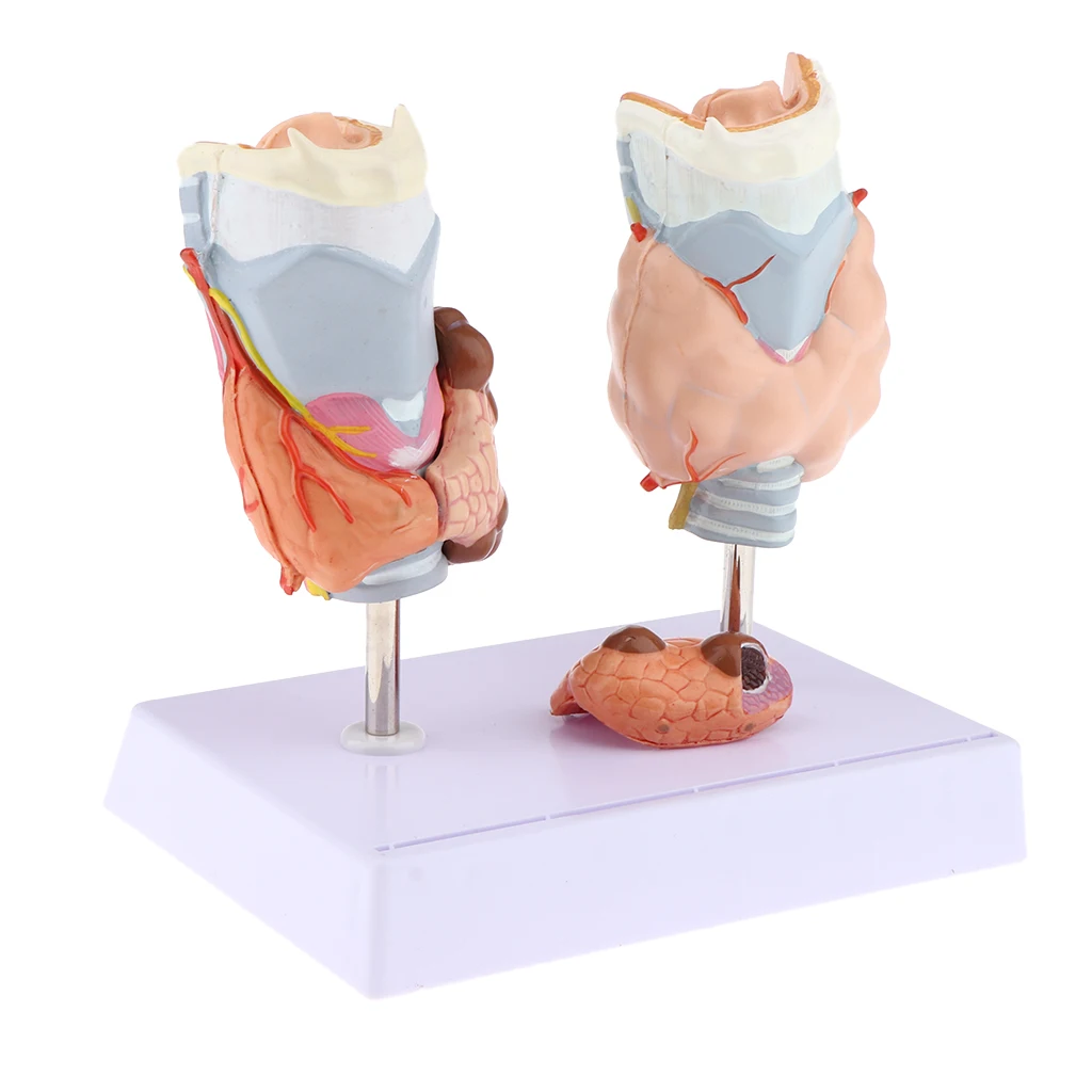 Human Anatomical Thyroid Gland Pathology Anatomy Medical Teaching Model - Lab Supplies Science Classroom Education