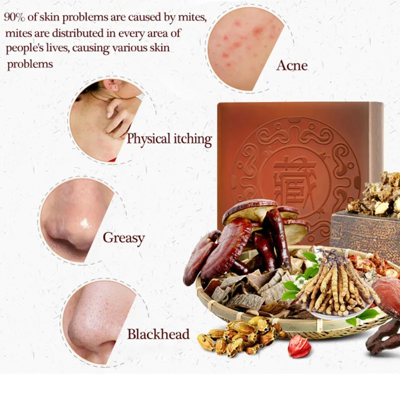 Tibetan Handmade Soap Moisturizing Oil-control Shrinking Pores Anti Mites Anti Acne Cleansing Soap 100g
