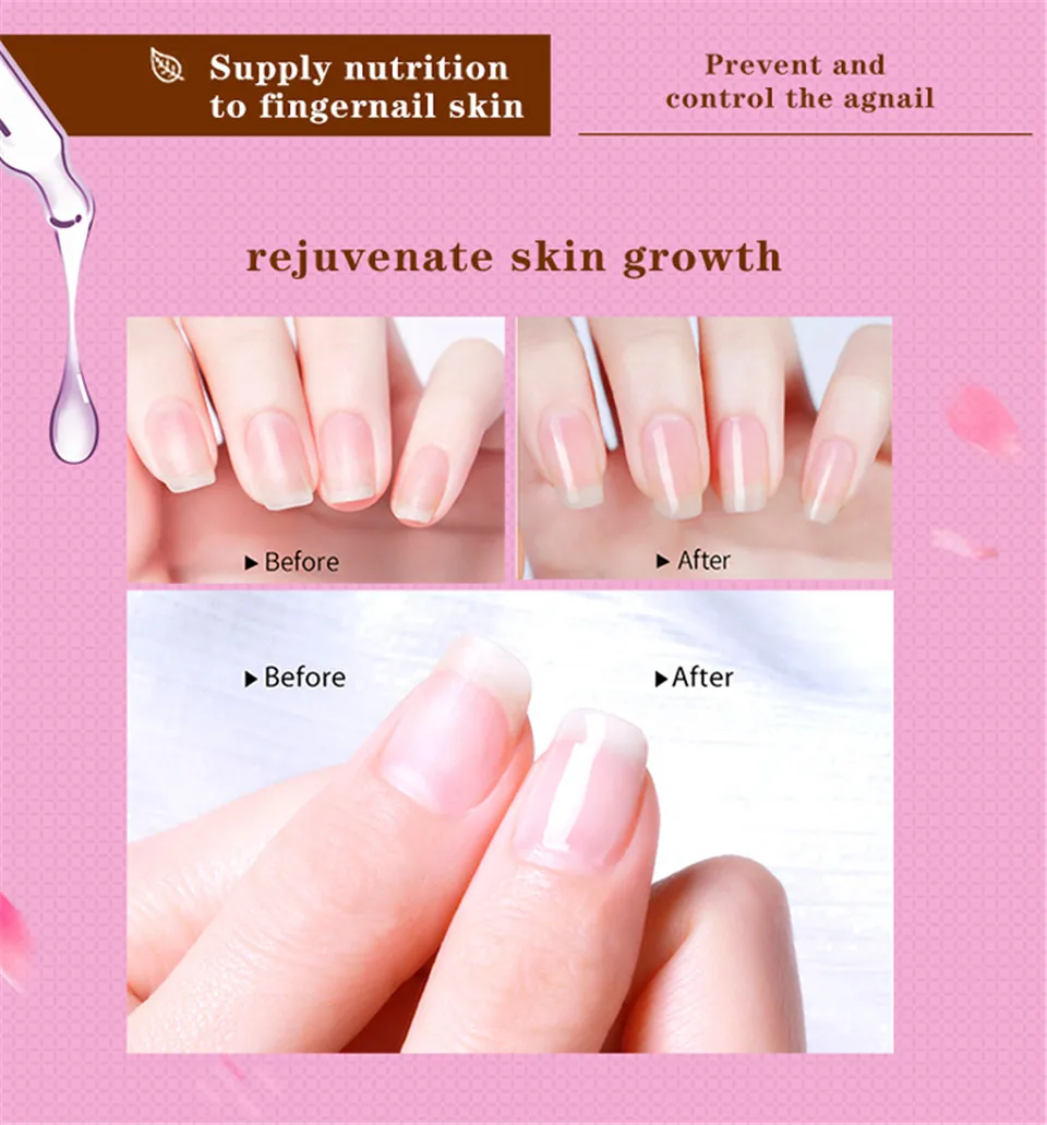 20ml Lily Cuticle Oil Revitalizer Nails Care Accesoires Supplies for
