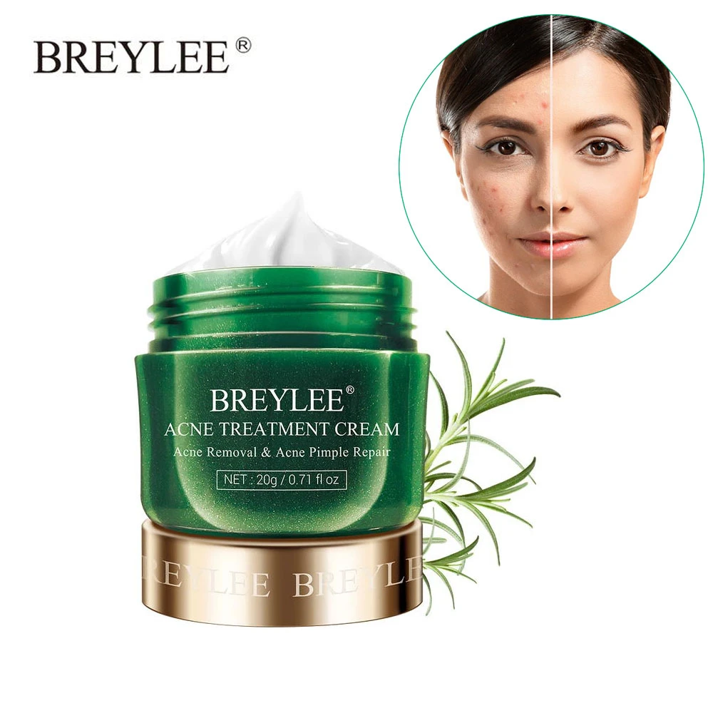 acne face moisturizer