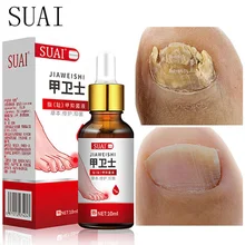 

Nail Fungus Treatment Paronychia Anti-fungal Repair Essence Foot Serum Onychomycosis Toe Fungus Anti-infection Removal Gel Care