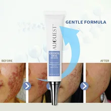 Крем от акне, увлажняющее масло Управление уменьшение пор, акне точек крем для удаления шрамов восстанавливающий крем с QRD88