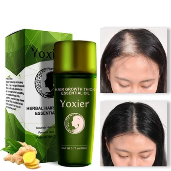 

Hot Hair Growth Thicken Essential Oil Nourishing Hair Scalp Anti-hair Loss Hair Regrowth Oil