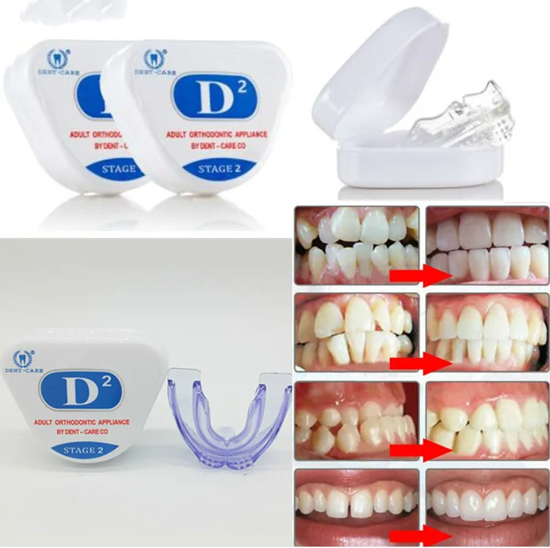 

Orthodontic Braces Dental Braces Instant Smile Silicone Teeth Alignment Trainer Teeth Retainer Mouth Guard Braces Tooth Tray