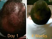 Crecimiento del cabello Aceites esenciales Esencia Anti Pérdida del cabello Productos Cuidado de la salud Belleza Crecimiento más rápido Crecimiento denso Cuidado del cabello Suero líquido