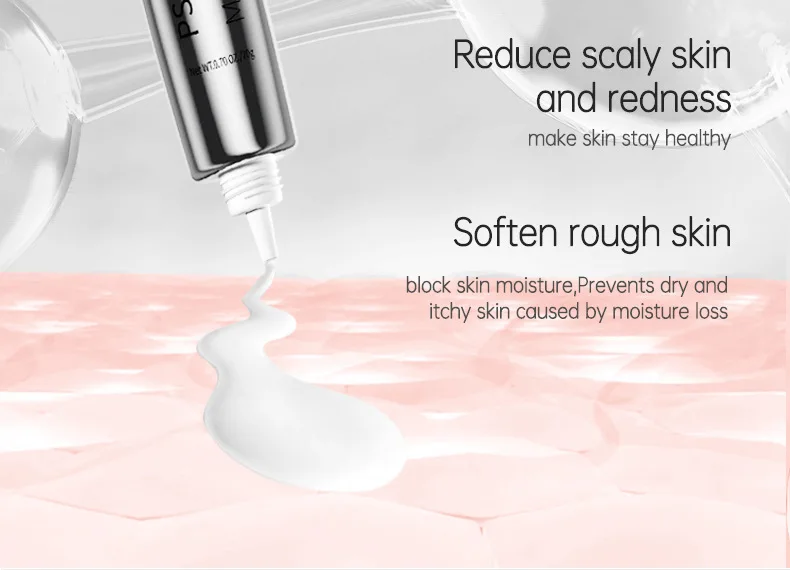 Skin Ringworm King Ointment To Treat Itching And Antipruritic Remove