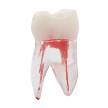 

1pc 1:1 Resin Dental Tooth Colored Root Canal and Pulp Model Dentist Tools