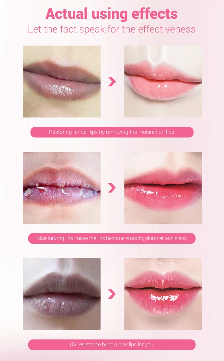 Lip Lightening Lipstick Lip Serum Cherry Moisturizing Remove Melanin Pink Lips Plumper Long Lasting Cosmetics Makeup