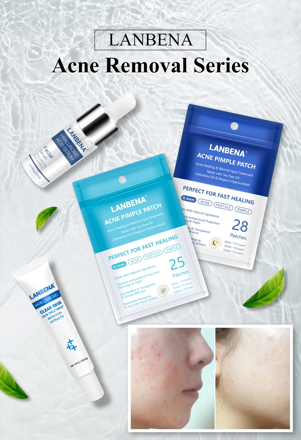 LANBENA маска для лица серия Acne Уход за кожей Гиалуроновая кислота сыворотка акне прыщи патч лечение акне гель для удаления прыщей крем для лица